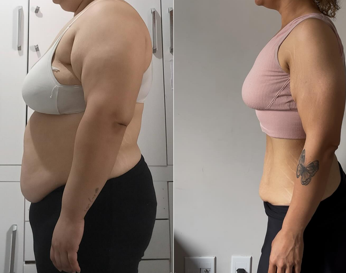 Prova social 2 - Comparação de perfil antes e depois mostrando grande perda de peso